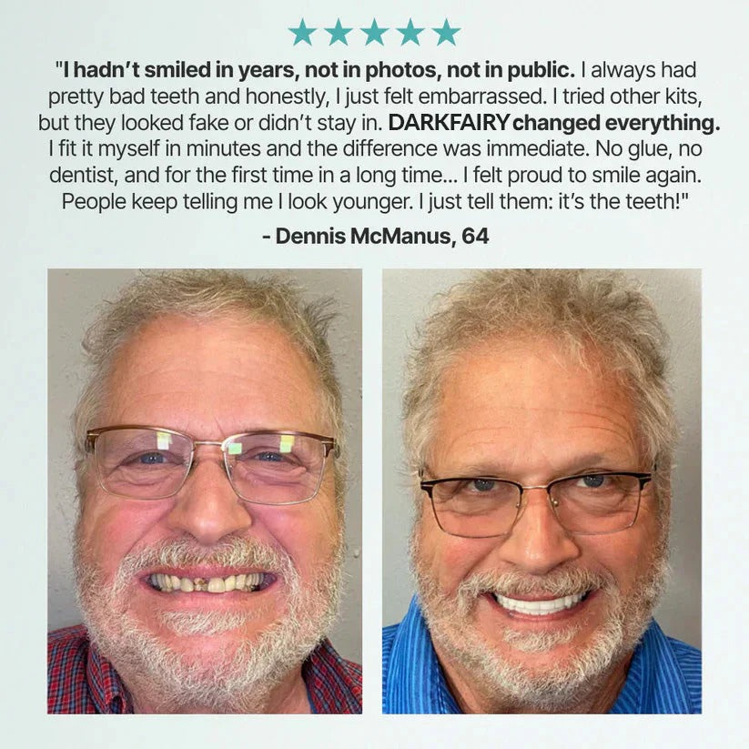 Custom-Fit Dentures - Designed for Comfort and a Natural-Looking Smile