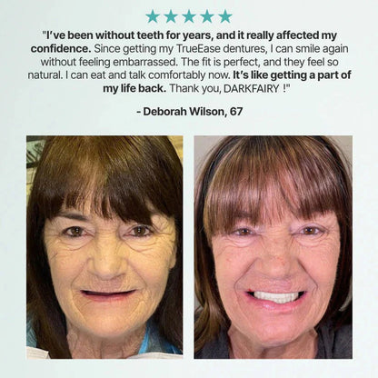 Custom-Fit Dentures - Designed for Comfort and a Natural-Looking Smile