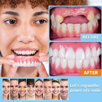 Custom-Fit Dentures - Designed for Comfort and a Natural-Looking Smile